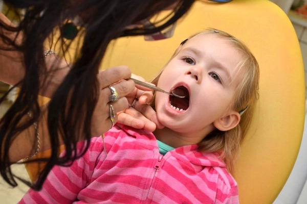Why Should I Choose Dental Fillings for My Child