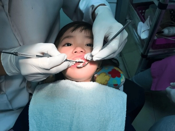 Why Should I Choose Dental Sealants for My Child