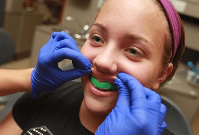 Why Should I Choose a Sports Mouthguards for My Child