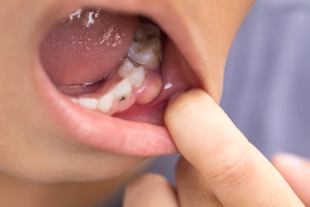 Why Should I Seek Treatment for Swelling or Infection